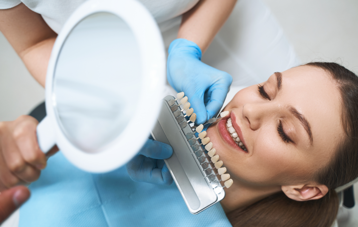 chirurgien dentiste composites montagny Facettes dentaires Cabinet dentaire EORA