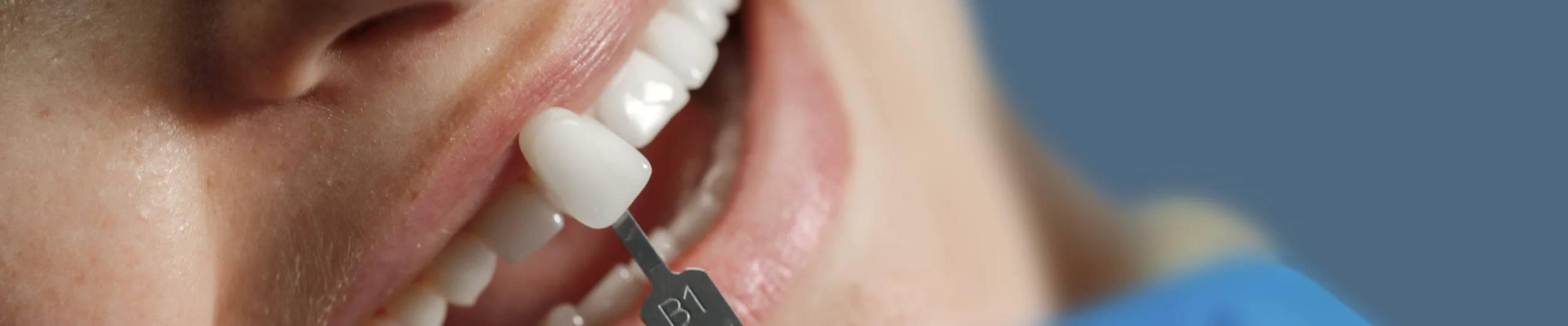 chirurgien dentiste dentisterie restauratrice scaled Nos conseils Cabinet dentaire EORA