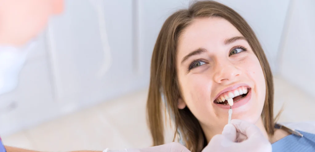 chirurgien dentiste facettes eora Facettes dentaires Cabinet dentaire EORA