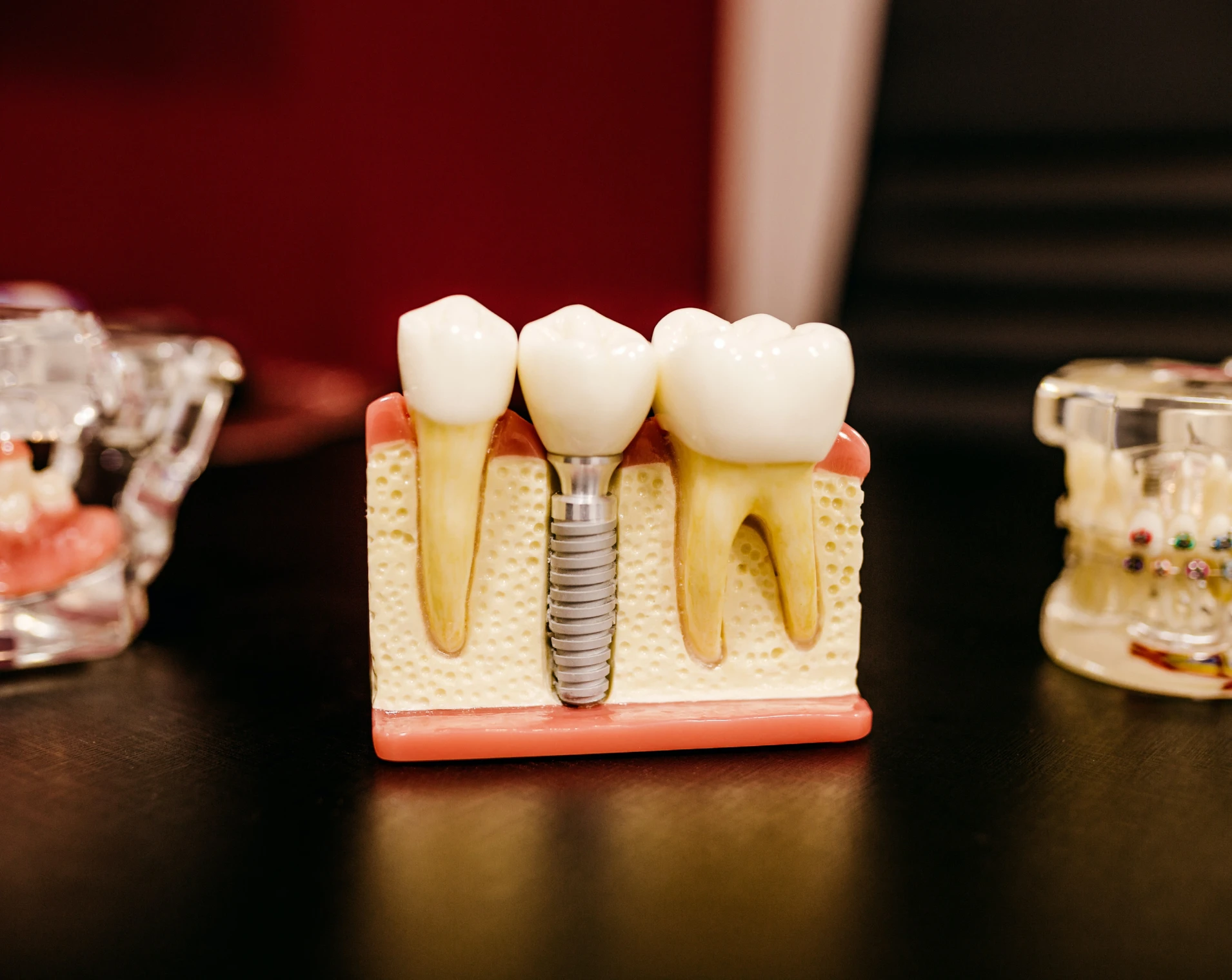 chirurgien dentiste bridge montagny  Cabinet dentaire EORA