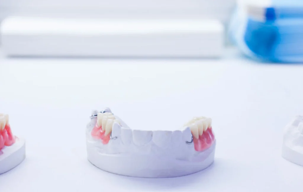 couronne dentaire chirurgien dentiste Bridge dentaire Cabinet dentaire EORA