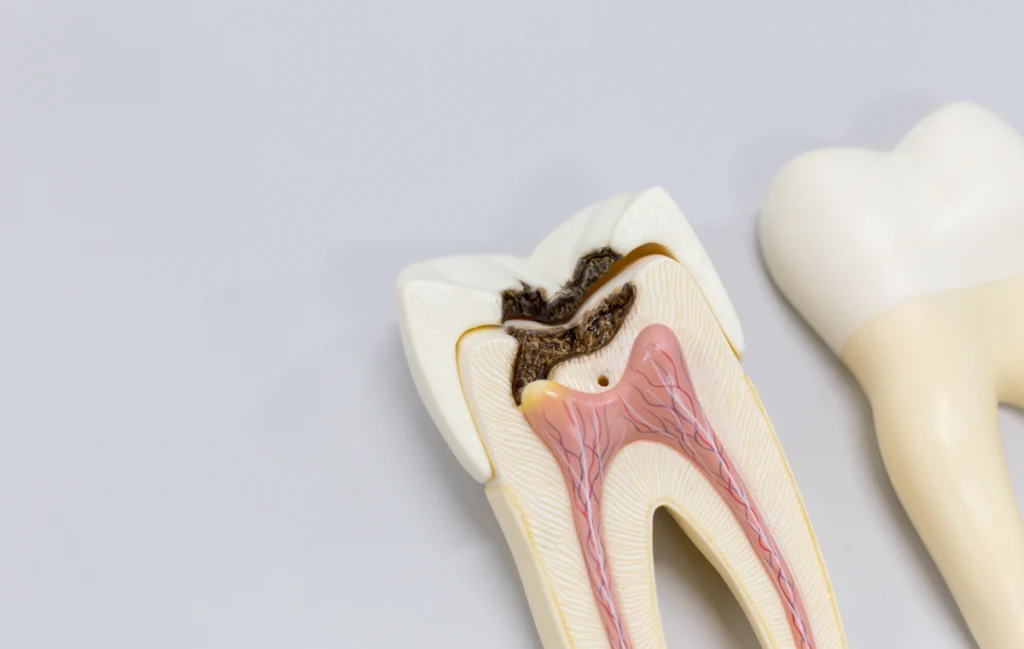 restauration complete chirurgien dentiste Dentisterie restauratrice Cabinet dentaire EORA